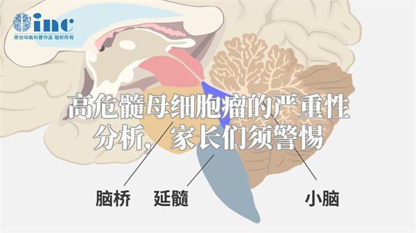 高危髓母细胞瘤的严重性分析，家长们须警惕