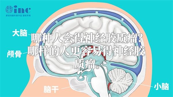 哪种人会得神经胶质瘤？哪样的人更容易得神经胶质瘤。