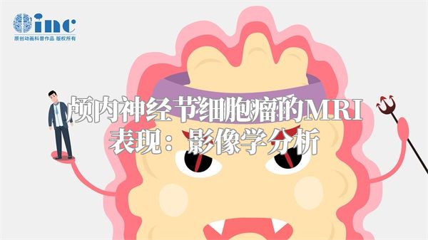 颅内神经节细胞瘤的MRI表现：影像学分析