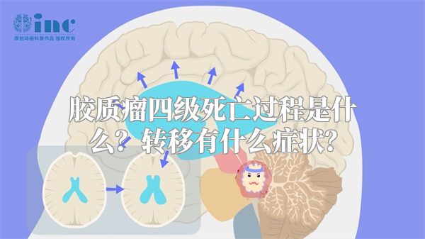 胶质瘤四级死亡过程是什么？转移有什么症状？