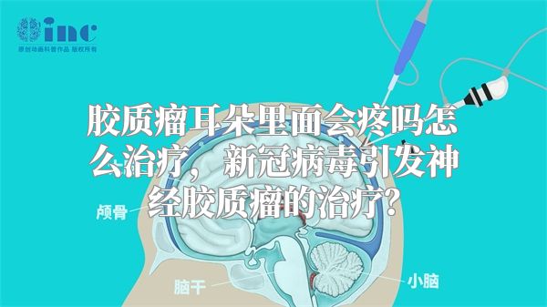 胶质瘤耳朵里面会疼吗怎么治疗，新冠病毒引发神经胶质瘤的治疗？