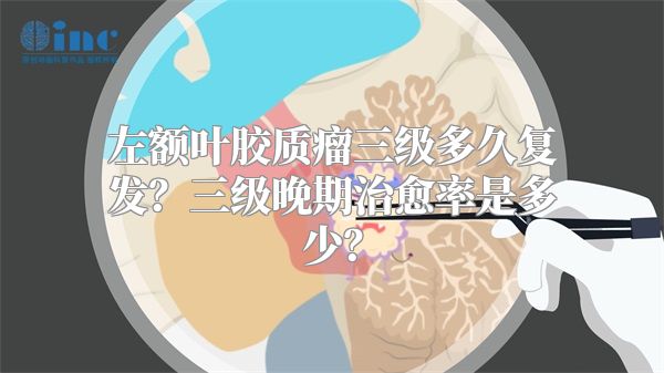 左额叶胶质瘤三级多久复发？三级晚期治愈率是多少？