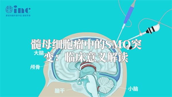 髓母细胞瘤中的SMO突变：临床意义解读