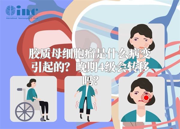 胶质母细胞瘤是什么病变引起的？晚期4级会转移吗？