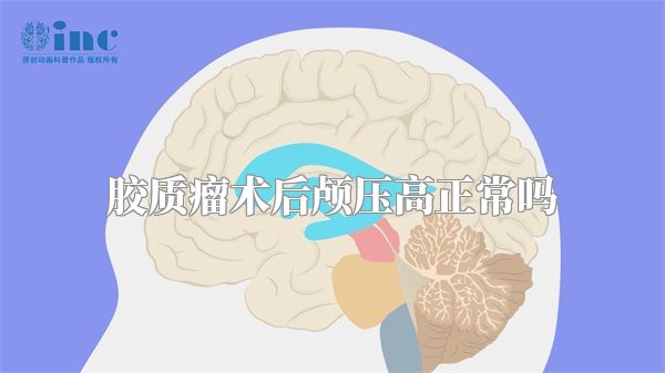 胶质瘤术后颅压高正常吗