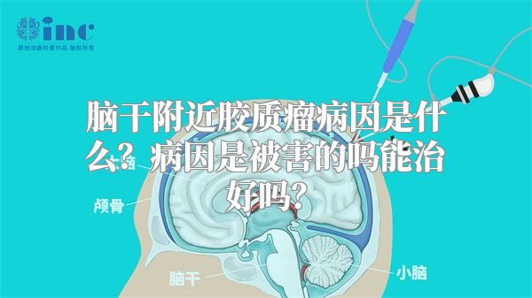 脑干附近胶质瘤病因是什么？病因是被害的吗能治好吗？