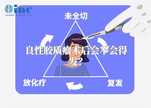 良性胶质瘤术后会不会得发？