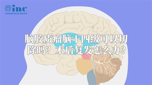 脑胶质瘤脑干四级可以切除吗？术后复发怎么办？