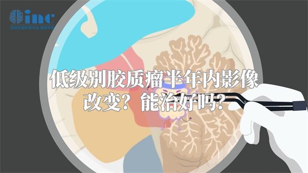 低级别胶质瘤半年内影像改变？能治好吗？