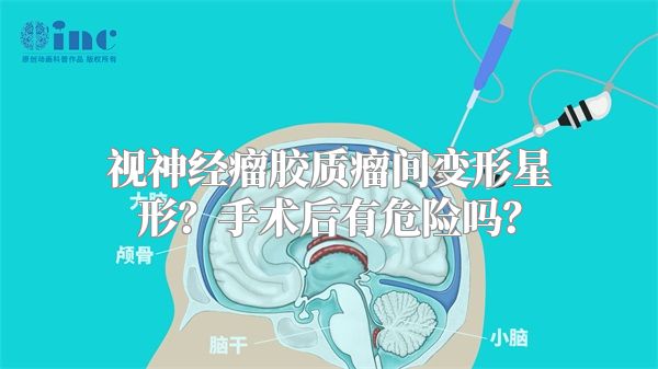 视神经瘤胶质瘤间变形星形？手术后有危险吗？