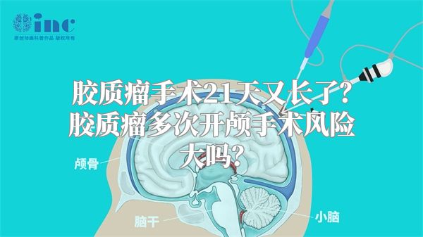 胶质瘤手术21天又长了？胶质瘤多次开颅手术风险大吗？