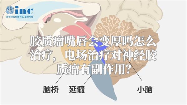 胶质瘤嘴唇会变厚吗怎么治疗，电场治疗对神经胶质瘤有副作用？