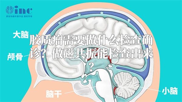 胶质瘤需要做什么检查确诊？做磁共振能检查出来？