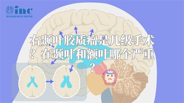 右颞叶胶质瘤是几级手术？在颞叶和额叶哪个严重？