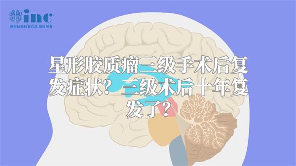 星形胶质瘤三级手术后复发症状？三级术后十年复发了？