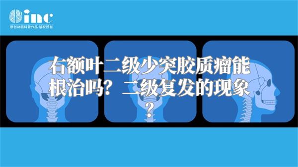 右额叶二级少突胶质瘤能根治吗？二级复发的现象？