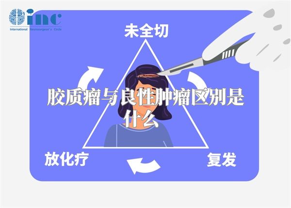 胶质瘤与良性肿瘤区别是什么  