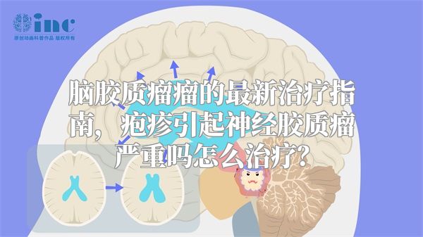 脑胶质瘤瘤的最新治疗指南，疱疹引起神经胶质瘤严重吗怎么治疗？