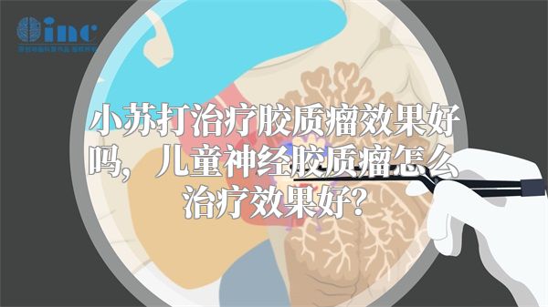 小苏打治疗胶质瘤效果好吗，儿童神经胶质瘤怎么治疗效果好？