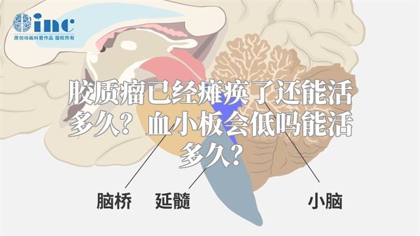 胶质瘤已经瘫痪了还能活多久？血小板会低吗能活多久？