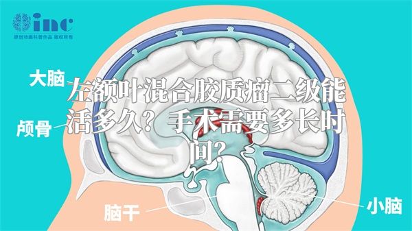 左额叶混合胶质瘤二级能活多久？手术需要多长时间？