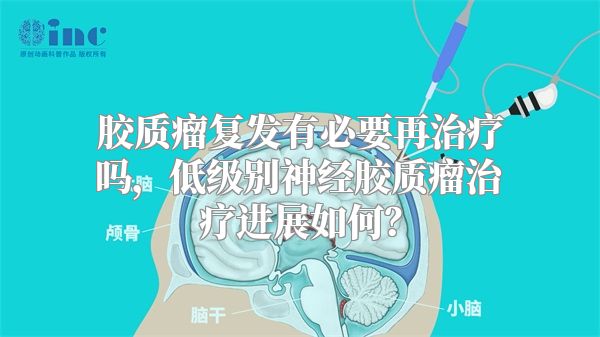 胶质瘤复发有必要再治疗吗，低级别神经胶质瘤治疗进展如何？