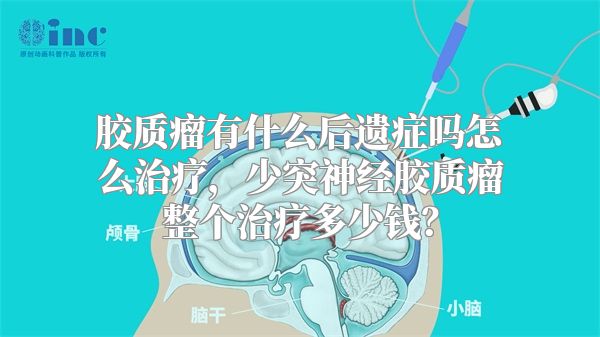 胶质瘤有什么后遗症吗怎么治疗，少突神经胶质瘤整个治疗多少钱？