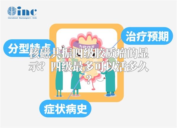 核磁共振四级胶质瘤的显示？四级最多可以活多久？