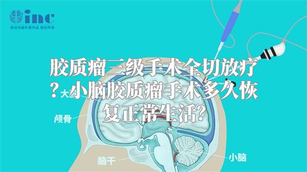 胶质瘤三级手术全切放疗？小脑胶质瘤手术多久恢复正常生活？