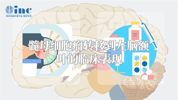 髓母细胞瘤转移到左脑额叶的临床表现