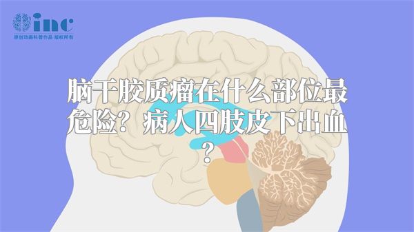 脑干胶质瘤在什么部位最危险？病人四肢皮下出血？