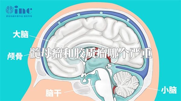 髓母瘤和胶质瘤哪个严重