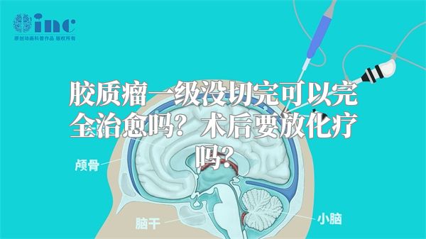 胶质瘤一级没切完可以完全治愈吗？术后要放化疗吗？