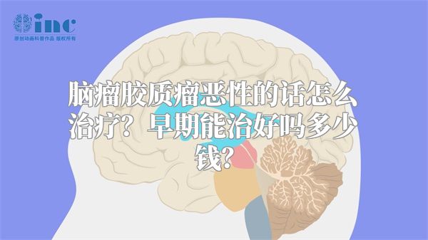 脑瘤胶质瘤恶性的话怎么治疗？早期能治好吗多少钱？