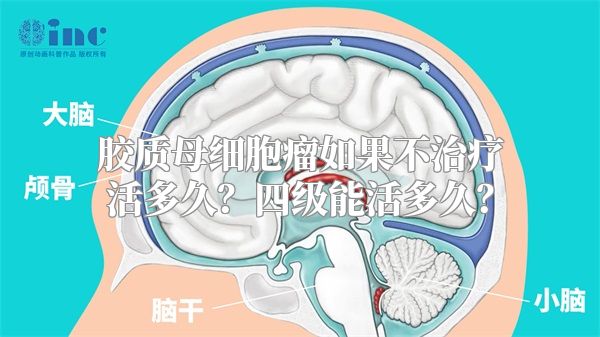 胶质母细胞瘤如果不治疗活多久？四级能活多久？