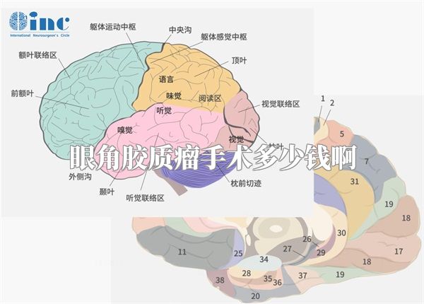 眼角胶质瘤手术多少钱啊