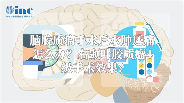 脑胶质瘤手术后水肿还痛怎么办？右颞叶胶质瘤4级手术效果？