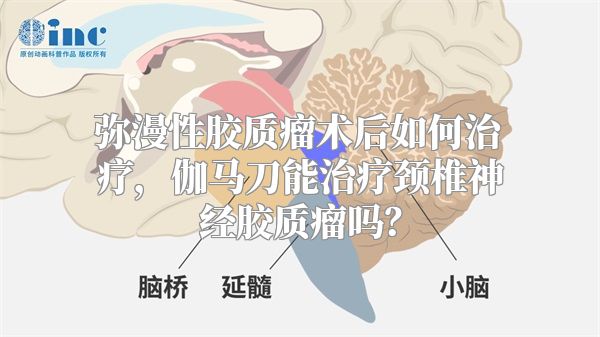 弥漫性胶质瘤术后如何治疗，伽马刀能治疗颈椎神经胶质瘤吗？