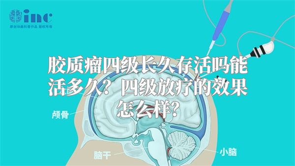 胶质瘤四级长久存活吗能活多久？四级放疗的效果怎么样？