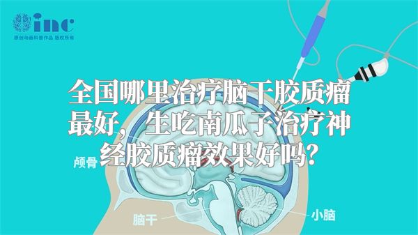 全国哪里治疗脑干胶质瘤最好，生吃南瓜子治疗神经胶质瘤效果好吗？