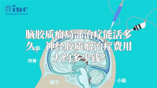 脑胶质瘤局部治疗能活多久，神经胶质瘤治疗费用大约多少钱？