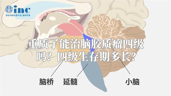 重质子能治脑胶质瘤四级吗？四级生存期多长？