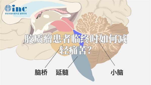 胶质瘤患者临终时如何减轻痛苦？