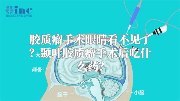 胶质瘤手术眼睛看不见了？颞叶胶质瘤手术后吃什么药？