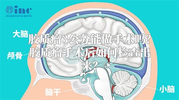 胶质瘤3公分能做手术吗？胶质瘤手术后如何检查出来？