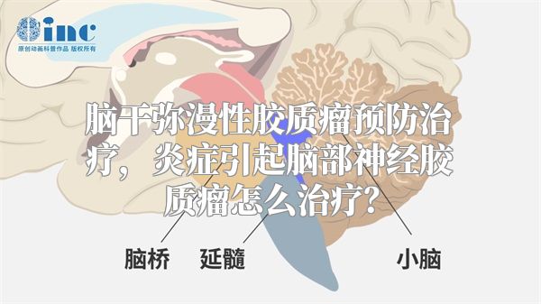 脑干弥漫性胶质瘤预防治疗，炎症引起脑部神经胶质瘤怎么治疗？