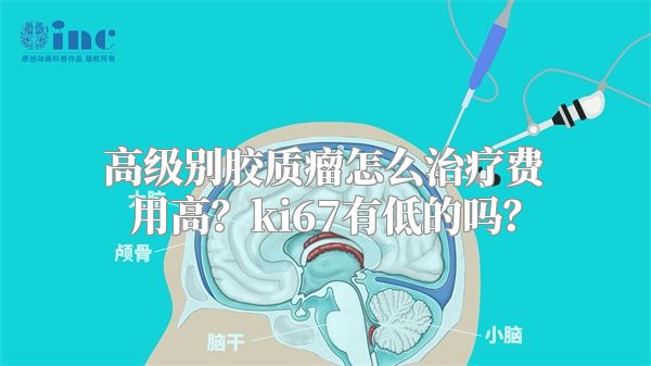 高级别胶质瘤怎么治疗费用高？ki67有低的吗？