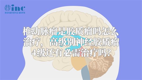 椎动脉瘤是胶质瘤吗怎么治疗，高级别神经胶质瘤4级还有必需治疗吗？