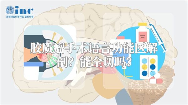 胶质瘤手术语言功能区解剖？能全切吗？