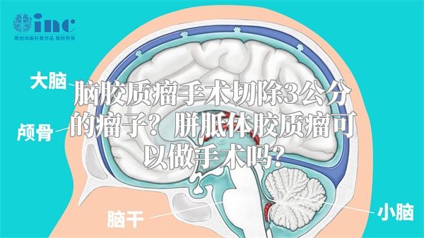 脑胶质瘤手术切除3公分的瘤子？胼胝体胶质瘤可以做手术吗？